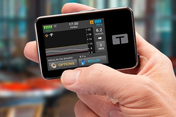 t:slim X2 insulin pump